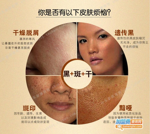 刘氏中药美白祛斑散加盟费