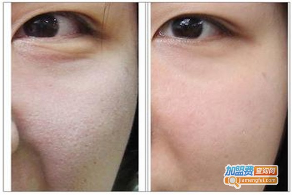 彩光嫩肤整形美容医院加盟