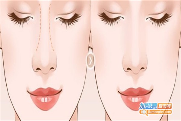 叶子整形美容加盟费