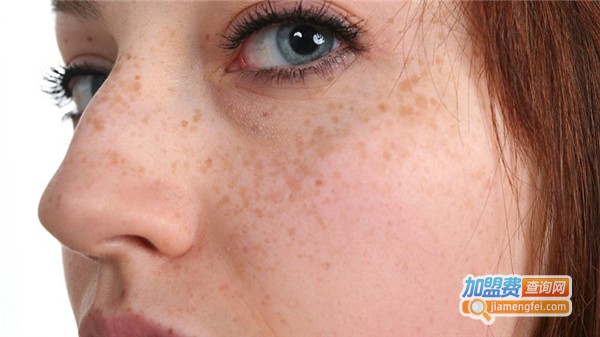 完美祛斑加盟费