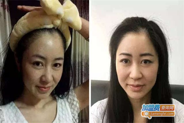 老中医祛斑加盟费总共多少钱？看加盟老中医祛斑都要支出多少钱！