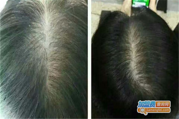 养发生发加盟费