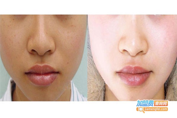 西子轩美容加盟费