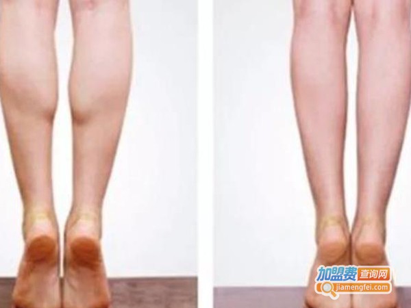 一指瘦减肥加盟费