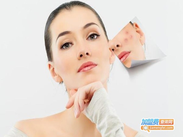 素叶子祛斑加盟费