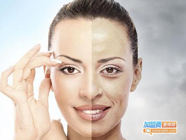 素叶子祛斑加盟费