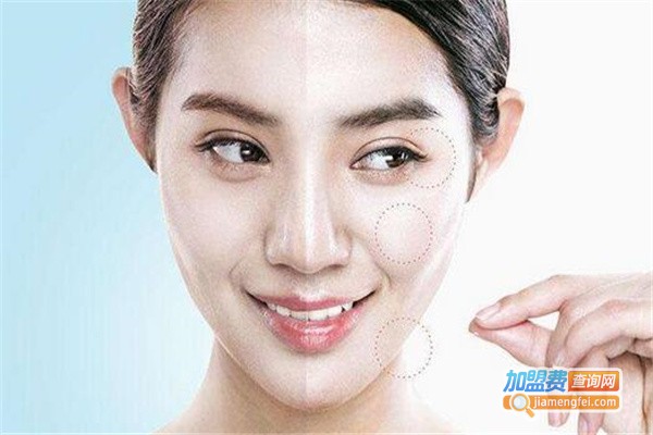 泓源鑫祛斑加盟