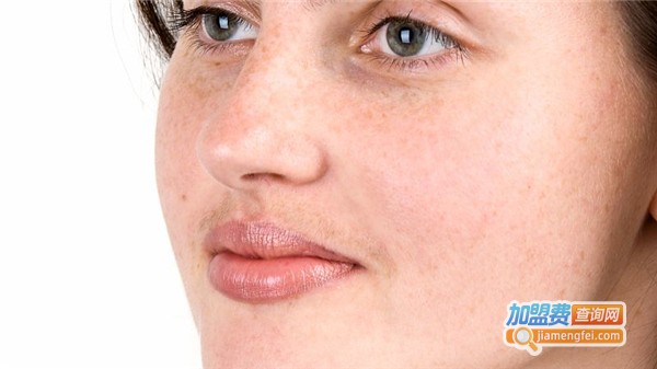 颜美国际祛斑加盟费