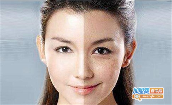 天御颜祛斑加盟费