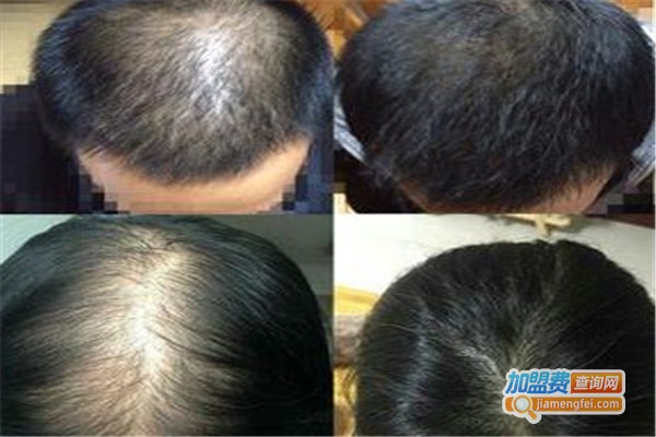 新丝维生发加盟费