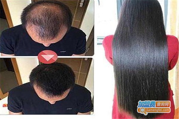 新丝维生发加盟费