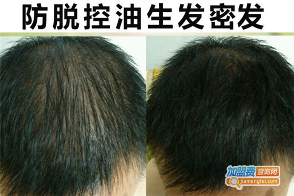 新丝维生发加盟费