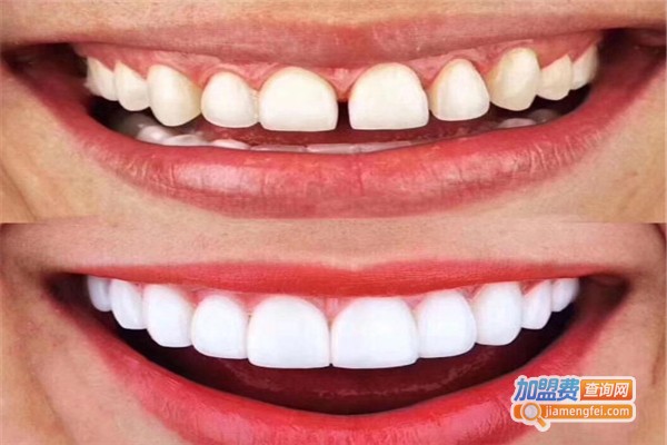 杭州美牙培训