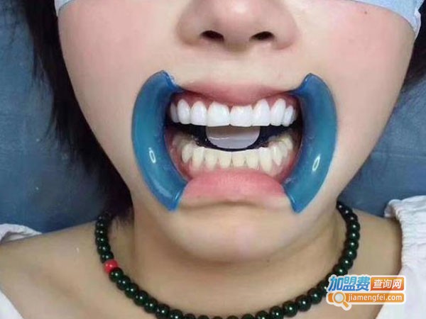 美牙技术培训加盟费