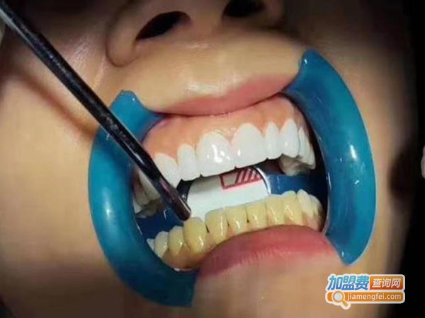 美牙技术培训加盟费