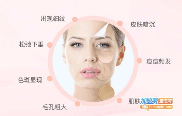 齐颜再生祛斑加盟费