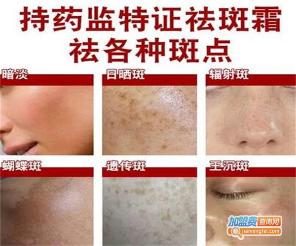 倩薇娜祛斑加盟费