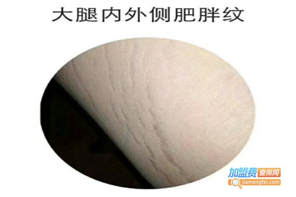 孕无纹国际加盟