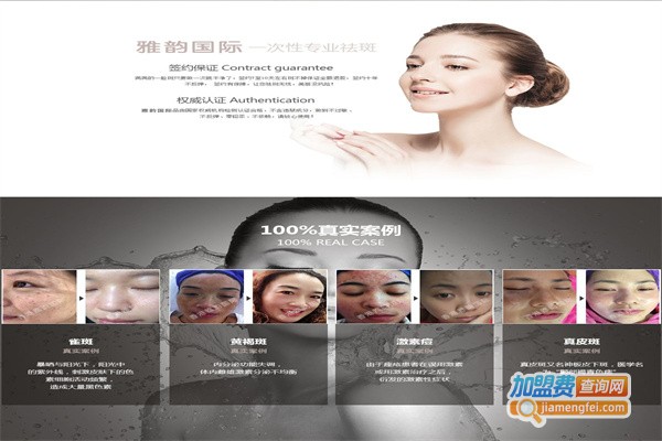 雅韵祛斑祛痘加盟费