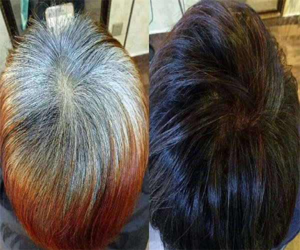 宫健飘中草药洗头加盟费