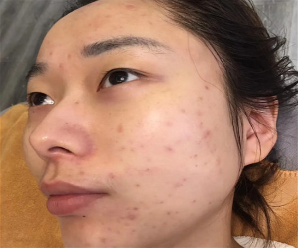 花巳中药面膜加盟费