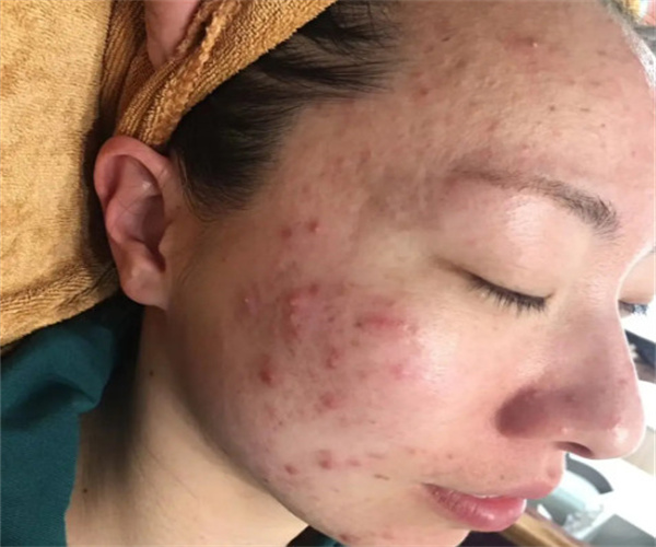 花巳中药面膜加盟费