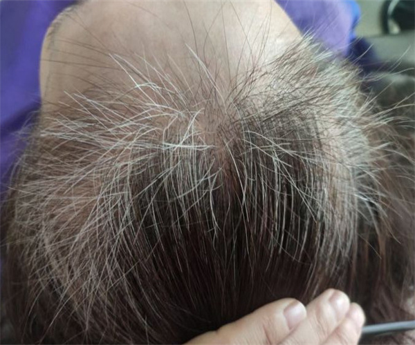 发一名养发加盟费