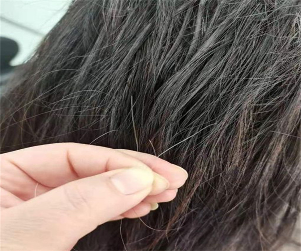 发一名养发加盟