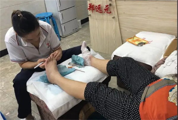 郑远元专业修脚店加盟费多少？