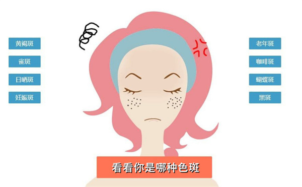 斑美宜祛斑