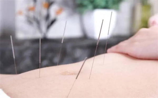 中医减肥连锁加盟