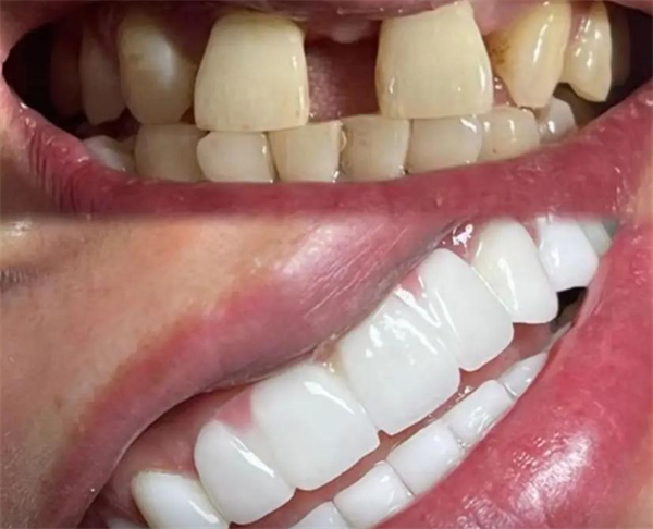 奈薇牙齿美学中心加盟