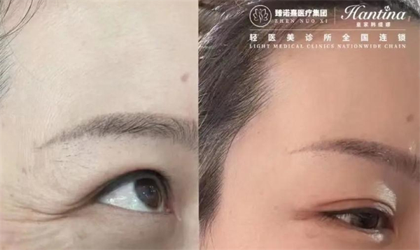 臻诺熹医疗美容加盟