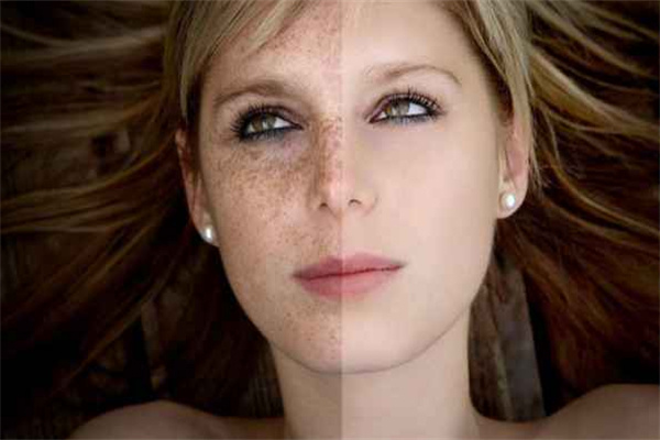 一何丽祛斑加盟