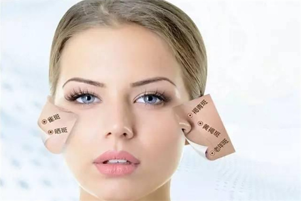 一何丽祛斑加盟