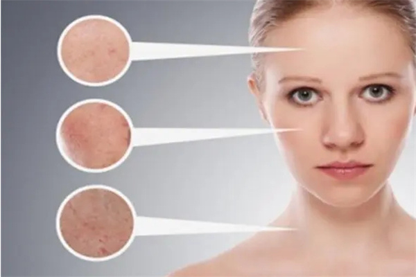 一何丽祛斑加盟