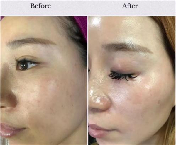 万黛摩颜祛斑加盟