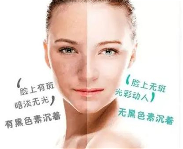 万黛摩颜祛斑加盟