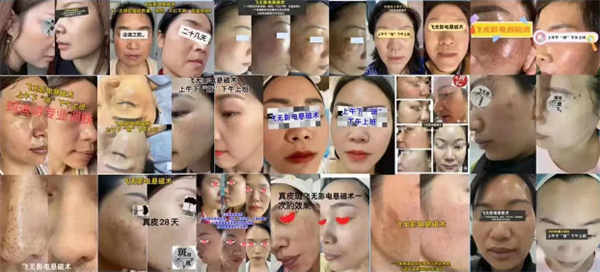 珂迪诗祛斑护肤品加盟费