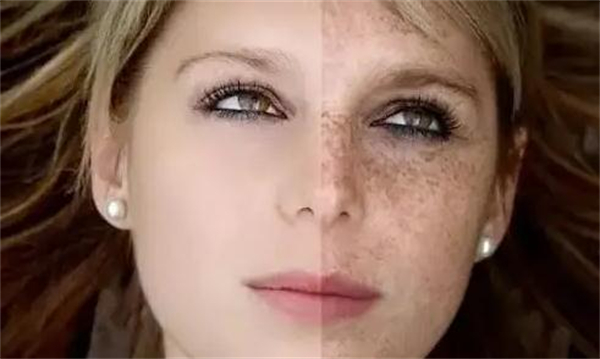 万黛摩颜祛斑加盟