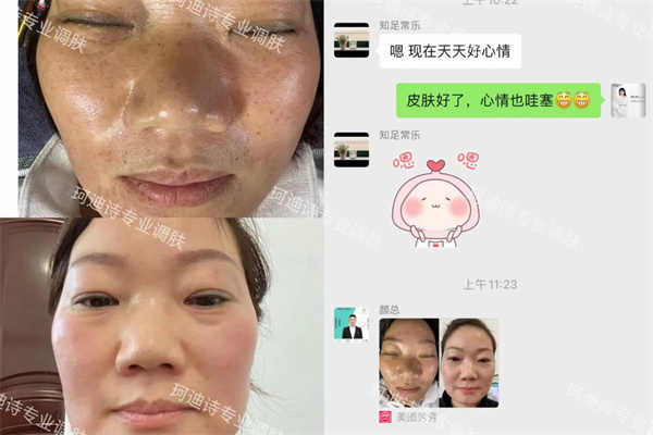 珂迪诗祛斑护肤品加盟费