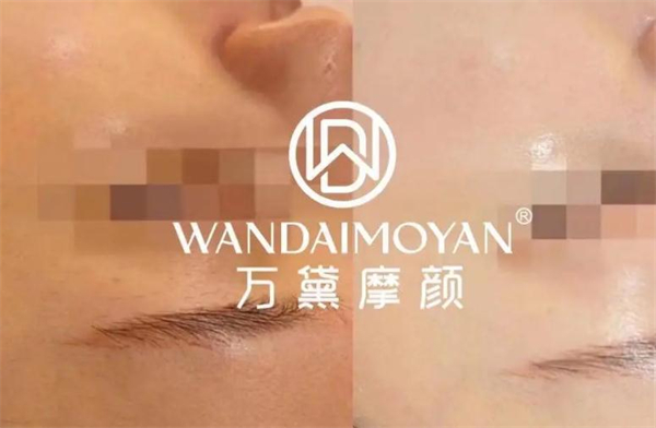 万黛摩颜祛斑加盟