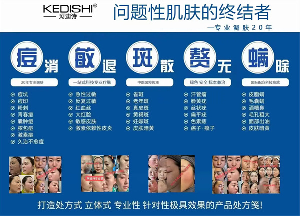 珂迪诗祛斑护肤品加盟费