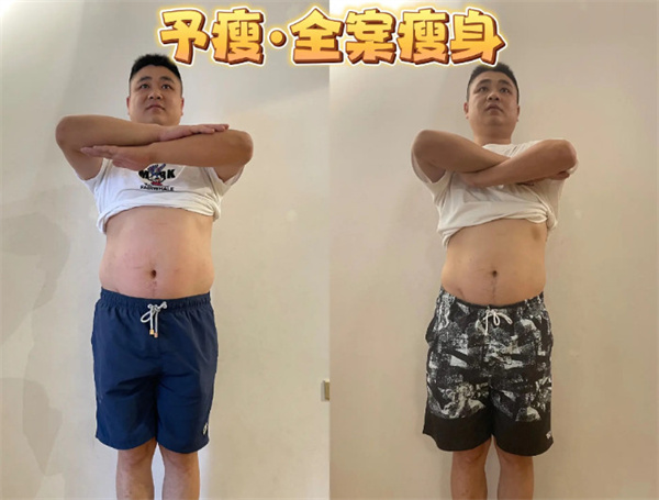 予瘦