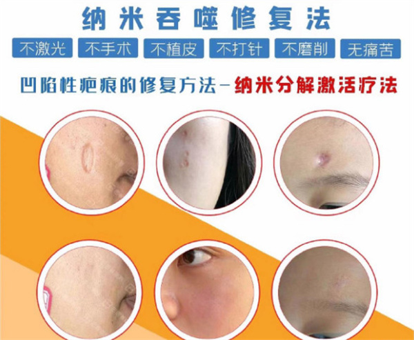 巴敏荟除疤加盟