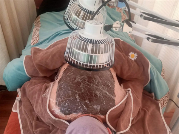 善柏龄七宝灸加盟