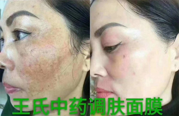 皇嘉俪颜王氏中药面膜加盟费